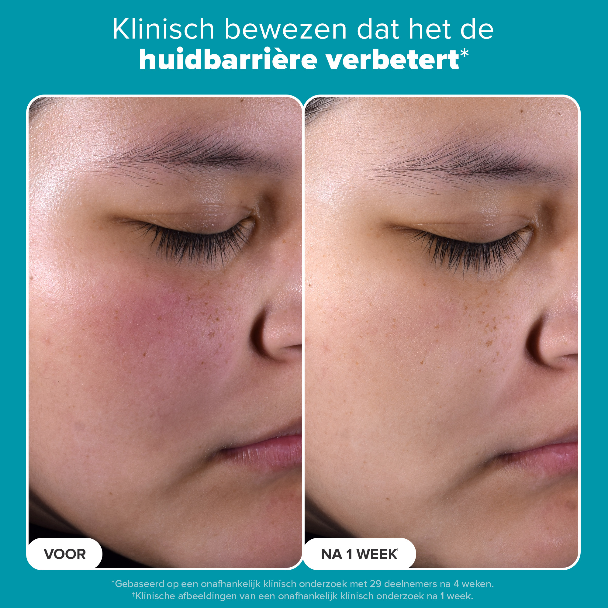 Skin Perfecting 2% BHA Liquid Exfoliant Skin Perfecting 2% BHA Liquid Exfoliant
